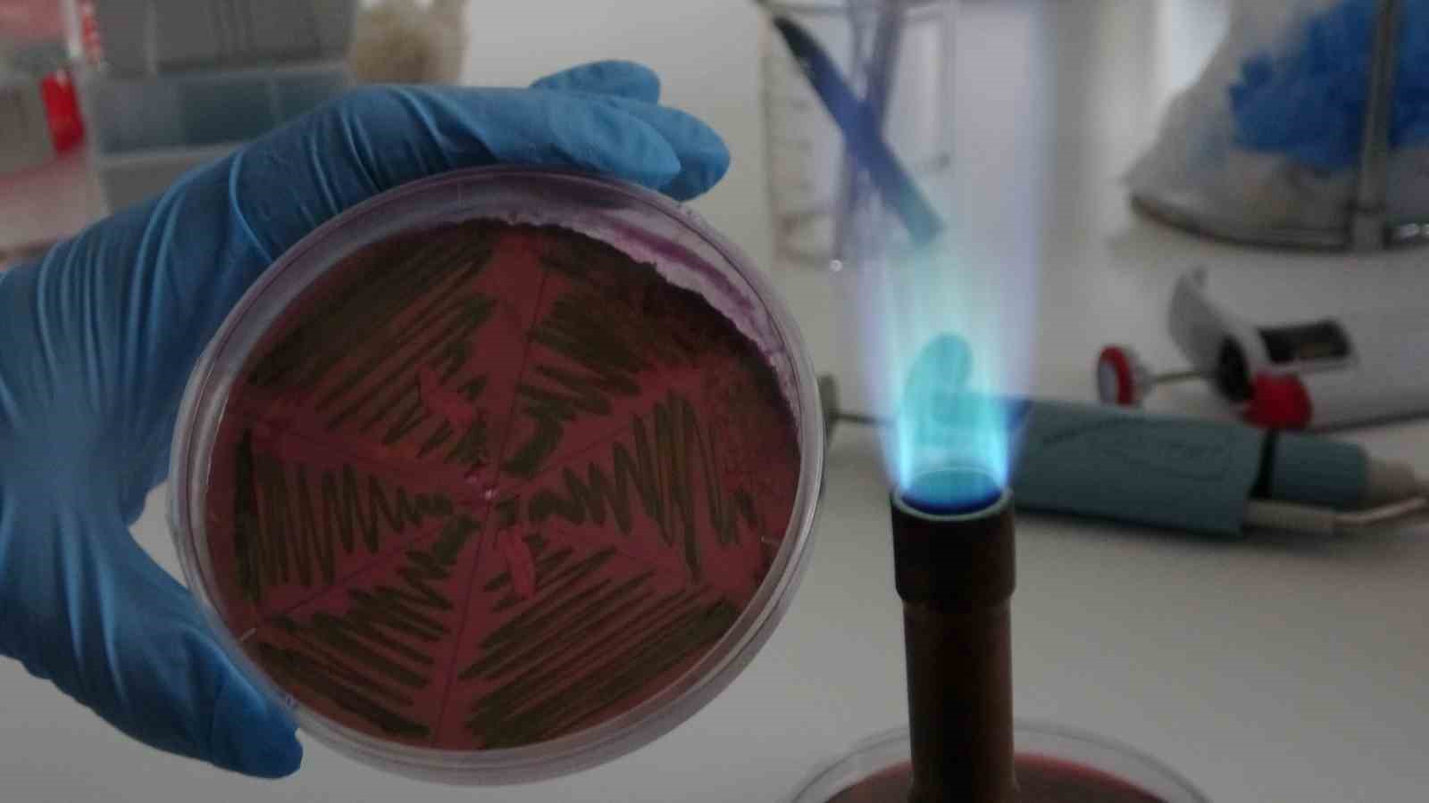 Çiğ süt, gıdayla bulaşan idrar yolu enfeksiyonlarına kapı açıyor
